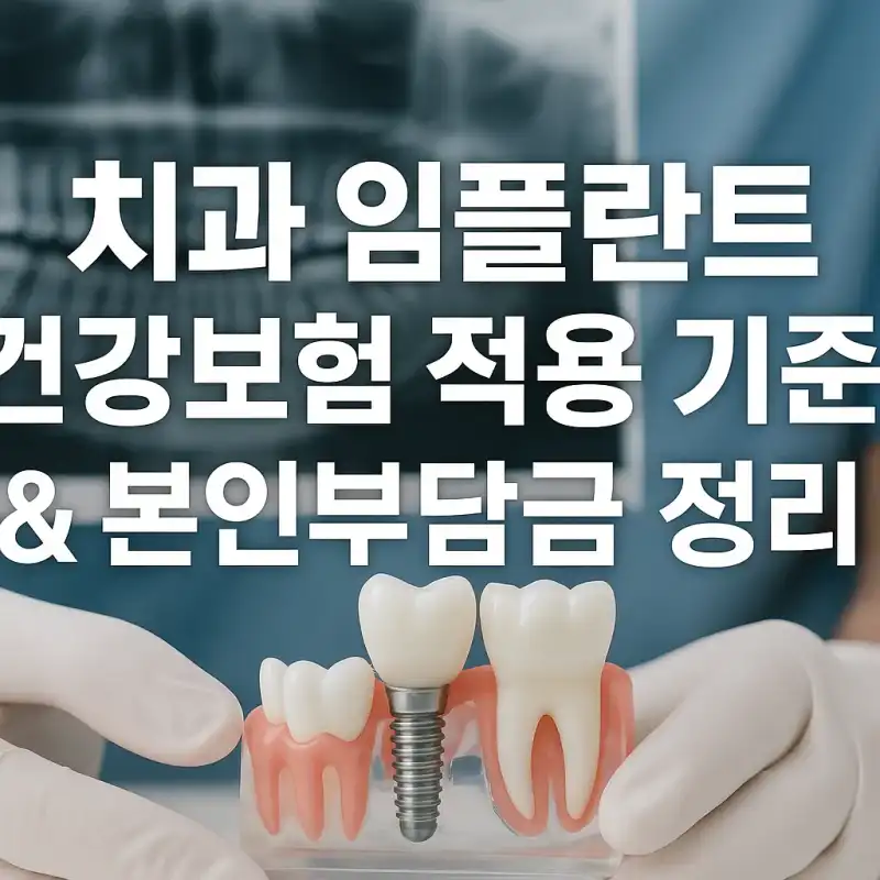 치과 임플란트 건강보험 적용 기준과 본인부담금 정리